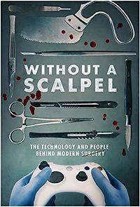 Watch Without a Scalpel