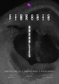 Watch Anomalies (Fibrosis)