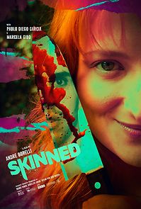 Watch Skinned