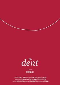 Watch The Dent