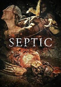 Watch Septic