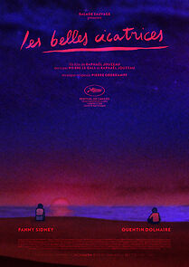 Watch Les belles cicatrices (Short 2024)