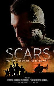 Watch Scars